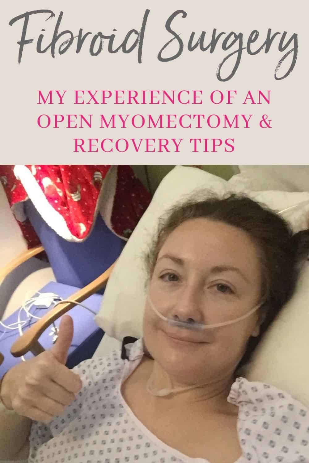 My experience of open myomectomy surgery to remove fibroids (and recovery tips). 